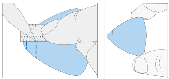 Screenshot that shows a plastic pick with 3mm and 6mm depth marks used for debonding.